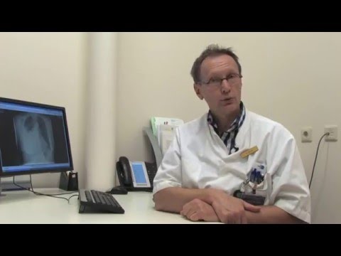 Video: Hepatosplenomegalie - Tekenen, Behandeling, Oorzaken, Vormen, Diagnose