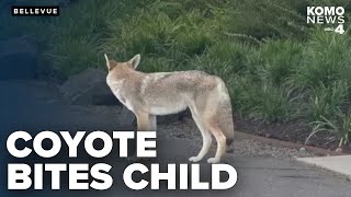 Celebrity Coyote bites child on hand in the latest in string of attacks in the Seattle area Profile