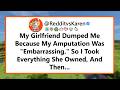 My Girlfriend Dumped Me Because My Amputation Was "Embarrassing."
