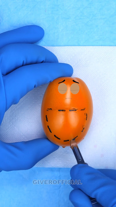 Tomato gives birth to a baby #fruitsurgery #shorts