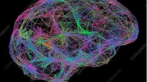 Neural pathways: Sean’s explanation of the brain’s electrical superhighway.