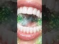 WARNING: What Lives In Your Mouth Will SHOCK You… (ProDentim Truth Revealed) #shorts