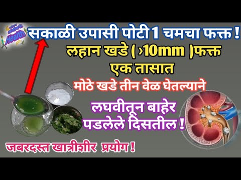 फक्त एक तासात मुतखडा विरघळून जातो,आजच खात्री करा,kidney stone relief