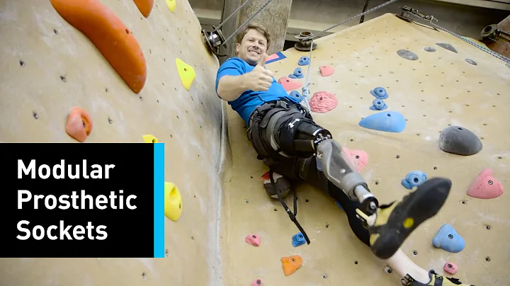 This Socket Design Is A Game-Changer In The Prosthetic World
