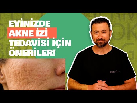 Evde akne izi (Skar) tedavisi mümkün mü?