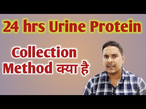 24 hrs urine collection procedure | 24 hr urine protein | urine protein test