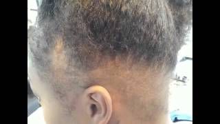 From Balding Edges To Flawless Style