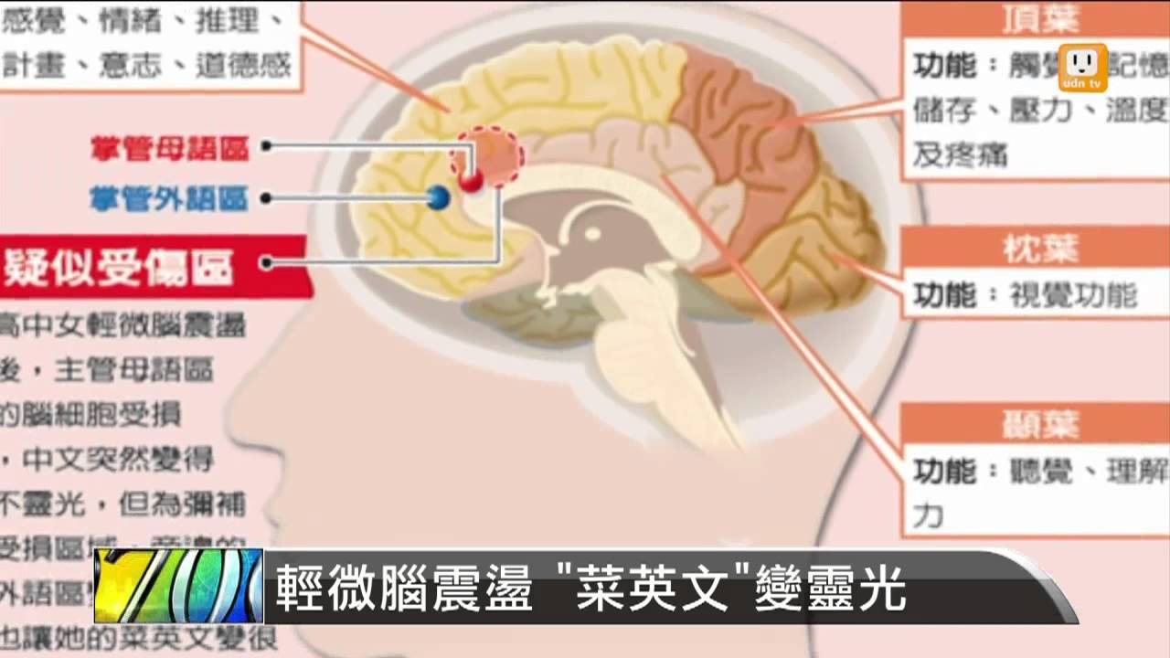 【2013.06.01】輕微腦震盪 