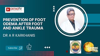 Prevention of Foot Odema after Foot and Ankle Trauma - Dr A R Karkhanis