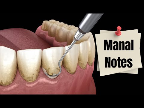 منال نوتز3   اختبار الهيئة السعودية للتخصصات الصحية طب اسنان اختبار برومترك