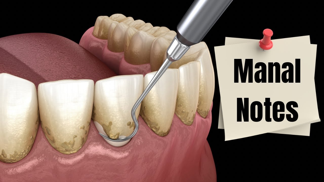 (منال نوتز3)periodontal instruments#اختبار الهيئة السعودية للتخصصات الصحية طب اسنان#اختبار برومترك