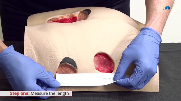 How to Measure a Wound | Measuring Wound Dimension...