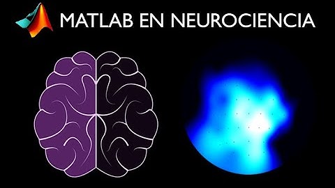 Curso MATLAB en neurociencia | Fieldtrip y EEG