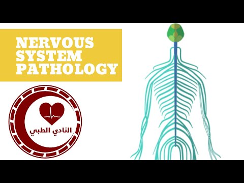 Video: Pilocytic Astrocytoma: Gejala, Kadar Kelangsungan Hidup, Dan Rawatan