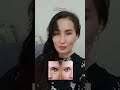 КАК УБРАТЬ МЕШКИ ПОД ГЛАЗАМИ ЛЕГКО И БЫСТРО #faceyoga #likes #botox #random #facemassage #rek