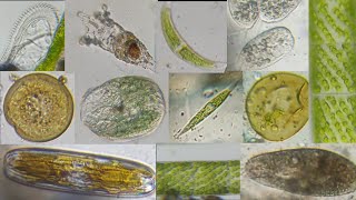 Under Microscope - Microorganisms - Microbes in Human Welfare | Protozoa Fresh Water Microorganisms