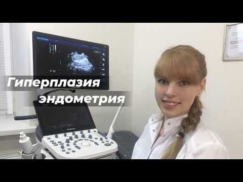 Гиперплазия эндометрия
