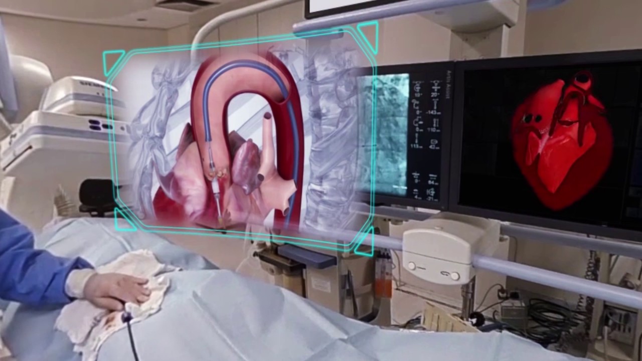 Fazendo uma Cirurgia de Joelho em Realidade Virtual - Wraith VR
