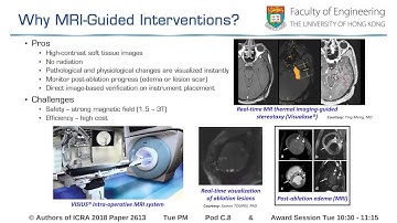 Compact Design of a Hydraulic Driving Robot for Intra-Operative MRI-Guided Bilateral Stereotactic Ne