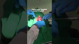 POV: CABUT GIGI BUNGSU 3 DETIK, DI HARI YANG SAMA BISA LANGSUNG MAKAN. MINIM BENGKAK DAN SAKIT.