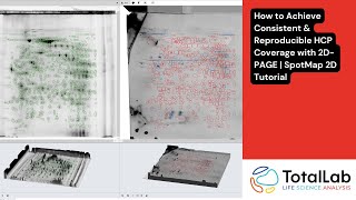 How To Achieve Consistent Reproducible Hcp Coverage With 2D-Page Spotmap 2D Tutorial