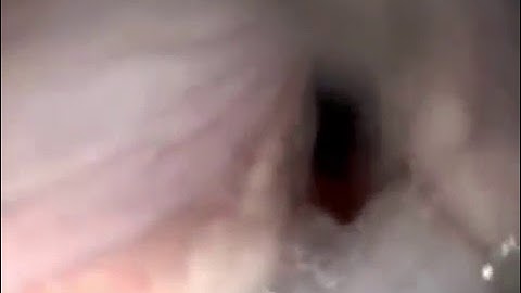 Movement of the everted laryngeal saccules (Cambridge BOAS research group)