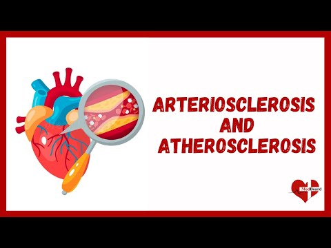 Video: Ce este ateroscleroza, arterioscleroza și arterioloscleroza?