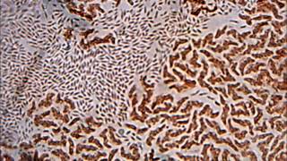 Neustonic bacteria