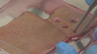 Invisible plaster speeds up wound healing say researchers