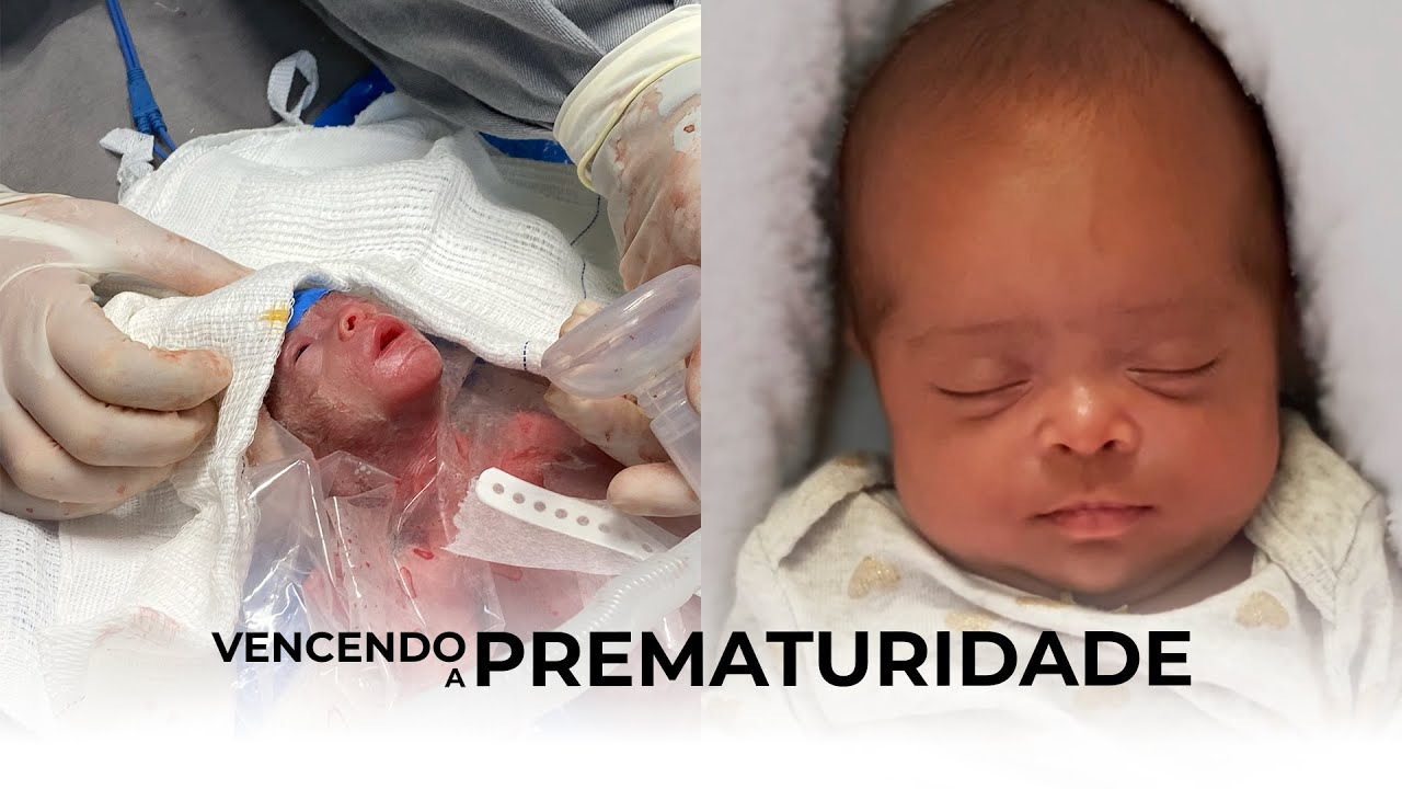 EP2 - O PARTO: Bebê Prematura com 28 semanas, Cesárea e UTI Neonatal SUS