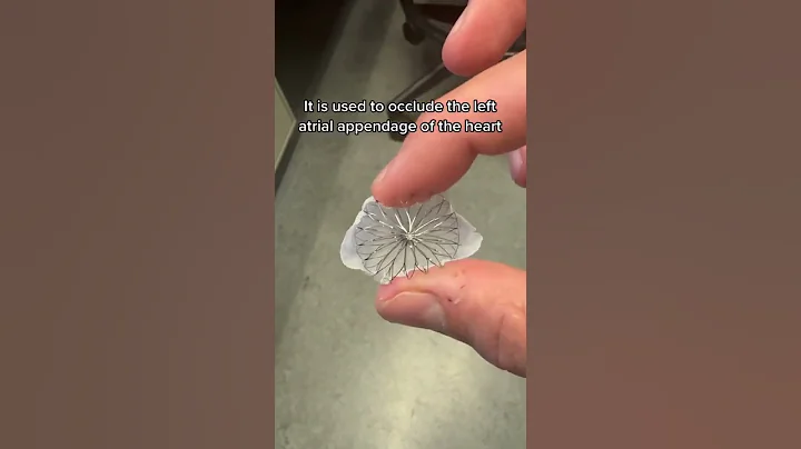 Watchman FLX device, used in very select patients with afib for stroke reduction!