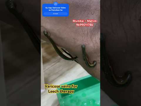 Power Of Leech