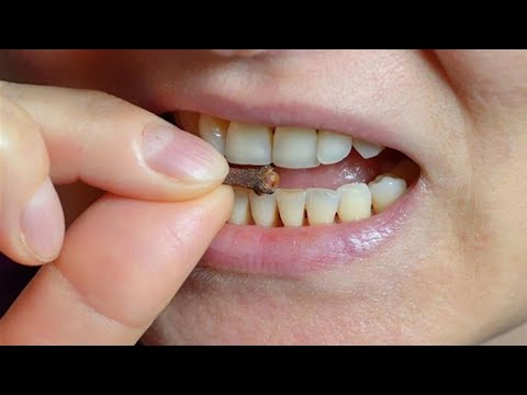 تخلص من الم الاسنان طول فصل الشتاء بحبه موجوده في بيتك
