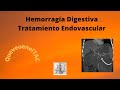 Sangrado abdominal. Tratamiento endovascular.