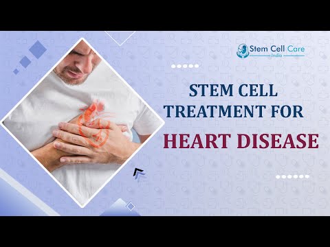 Best Stem Cell Treatment For Heart Disease | Affordable And Effective Treatment | Heart Disease |