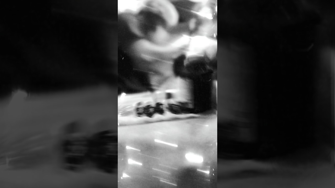 Best Hair Transplant Doctor