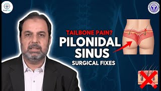 ⚕️ Pilonidal Sinus Explained: Symptoms, Causes, and Modern Surgical Fixes (SurgiTalks)