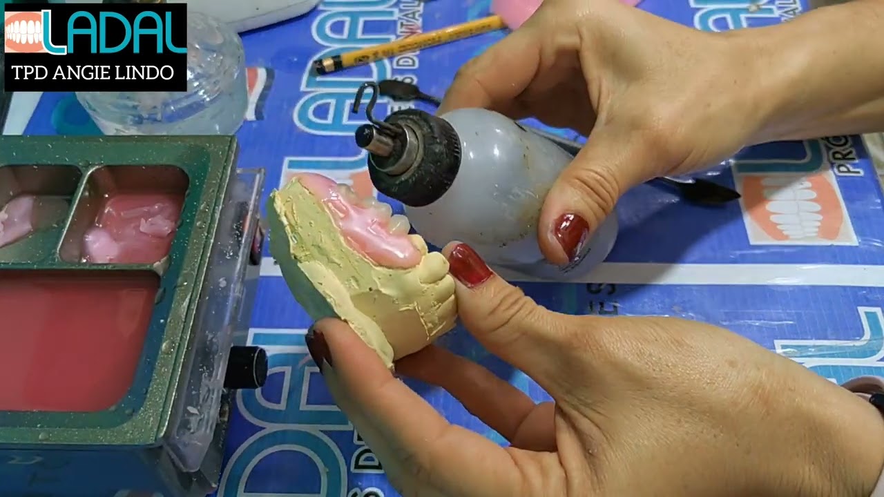 Diseño y encerado de prótesis flexible 