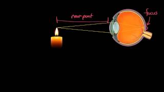 Famous Range of Vision of a Normal Eye - GCSE Physics Wealth