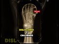 El fraude espiritista más famoso de la historia #Shorts #Espiritismo #Historia #MisteriosResueltos
