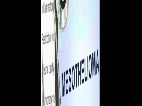 The Untold Story Behind This Indianapolis Mesothelioma Lawyers Vimeo