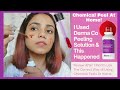 Chemical Peel At Home For Clear & Radiant Skin | The Derma Co 30% AHA 2% BHA Peeling Solution Review