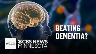 Interview with dementia patient diagnosed at 40 | Talking Points