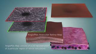AngioPlex® OCT Angiography од ZEISS