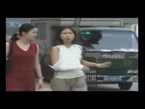 doc02(arm&sling).mpg