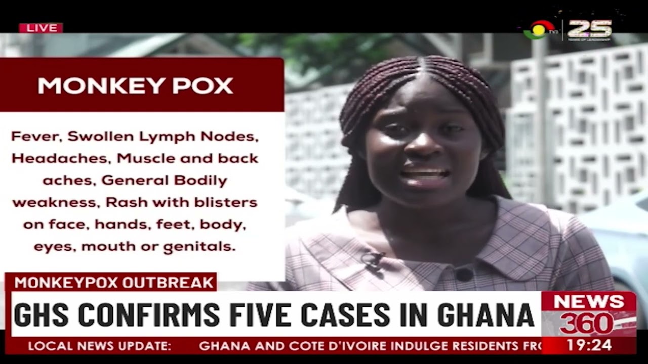 Monkeypox outbreak: GHS confirms five cases in Ghana