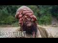 They Call Me 'The Man With No Face' | BORN DIFFERENT