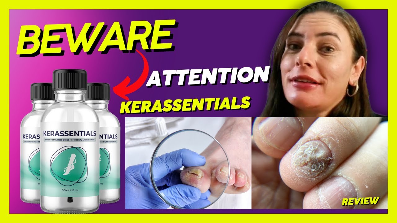 🔴Kerassentials for toenail fungus-KERASSENTIALS OIL NAIL FUNGUS