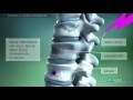 Spinal Deformities. Reasons