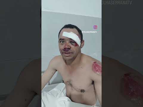 Aacidente na estrada no sítio foz Ismael bateu em  uma vaca #shorts